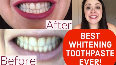 consumer reports best whitening toothpaste.